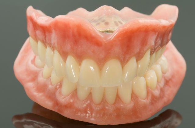 目立たない入れ歯なら精密義歯｜咬み合わせ専門歯科　高松市の吉本歯科医院