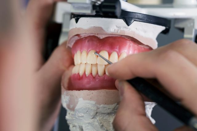 噛める総入れ歯なら咬み合わせ専門歯科｜高松市の吉本歯科医院